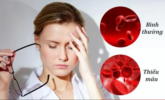 Medical image