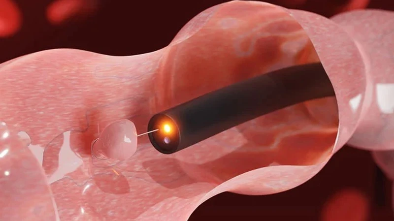 Medical image