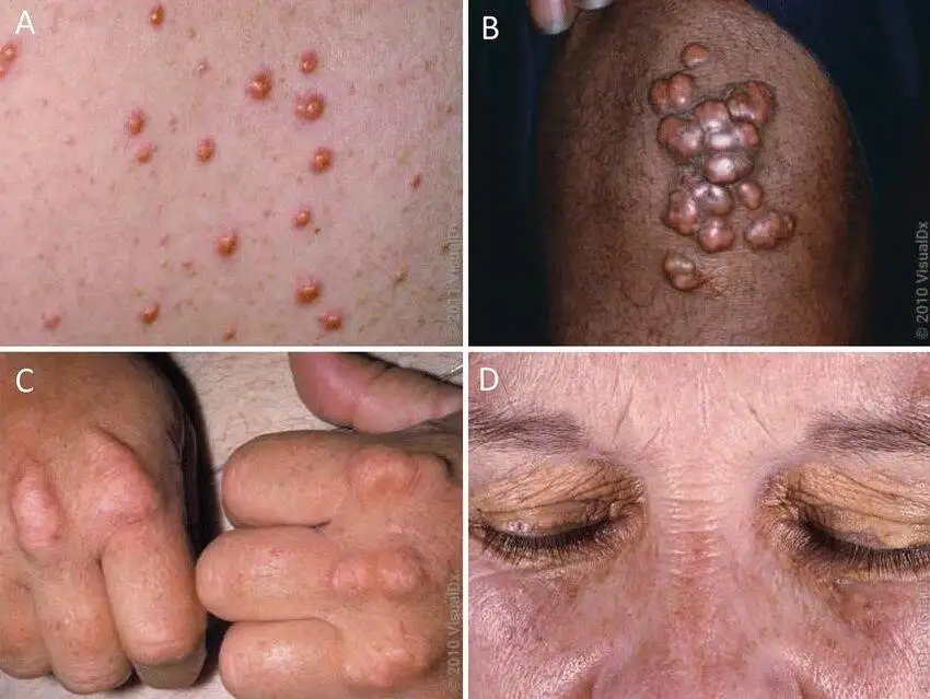 Medical image