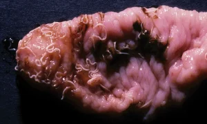 Medical image