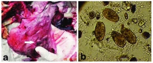 Medical image