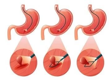 Medical image