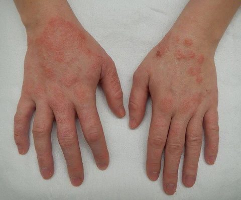 Medical image