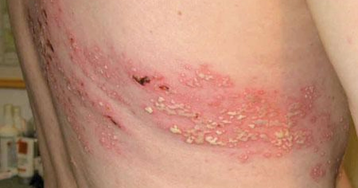 Medical image