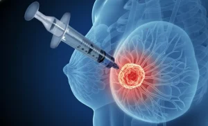 Medical image