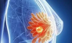 Medical image
