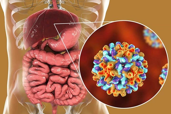 Medical image