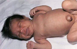 Xét nghiệm lấy máu gót chân tại Quy Nhơn: Phát hiện sớm và chẩn đoán bệnh ở trẻ sơ sinh