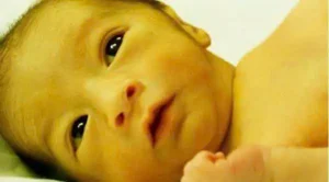 Thiếu Men G6PD Ở Trẻ Sơ Sinh: Nguyên Nhân, Triệu Chứng và Xét Nghiệm Sàng Lọc Sơ Sinh Tại Quy Nhơn