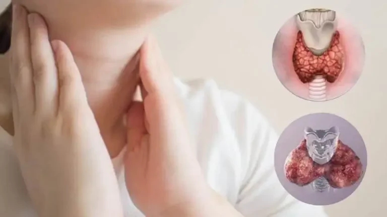 Suy Giáp Ở Trẻ Sơ Sinh: Nguyên Nhân, Triệu Chứng và Xét Nghiệm Sàng Lọc Sơ Sinh Tại Quy Nhơn
