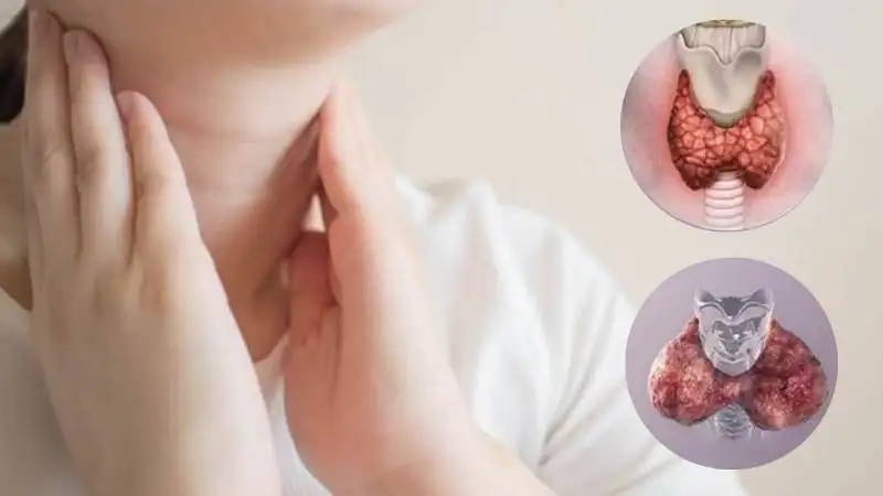 Suy Giáp Ở Trẻ Sơ Sinh: Nguyên Nhân, Triệu Chứng và Xét Nghiệm Sàng Lọc Sơ Sinh Tại Quy Nhơn