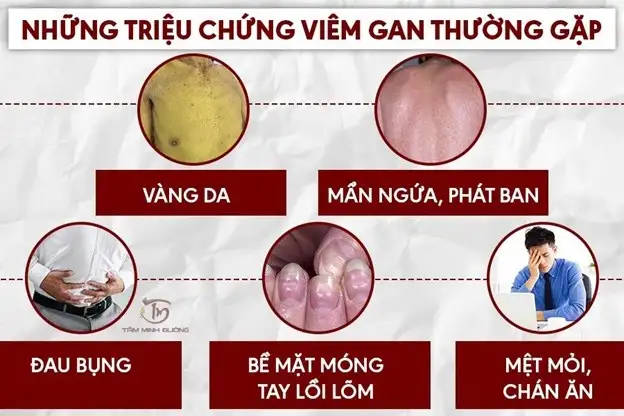 Viêm gan B có tự khỏi không?