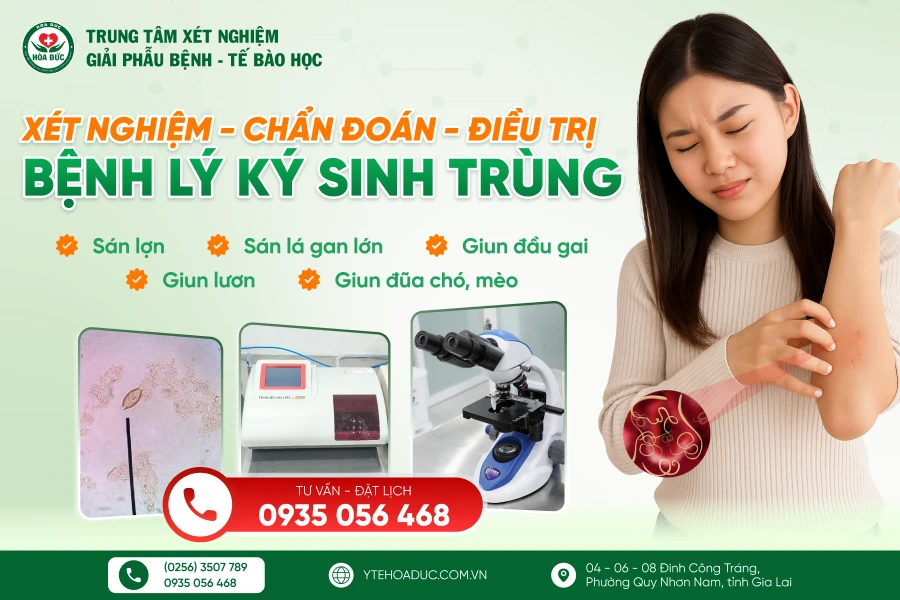 Gói xét nghiệm ký sinh trùng Hoà Đức Gói xét nghiệm ký sinh trùng Hoà Đức