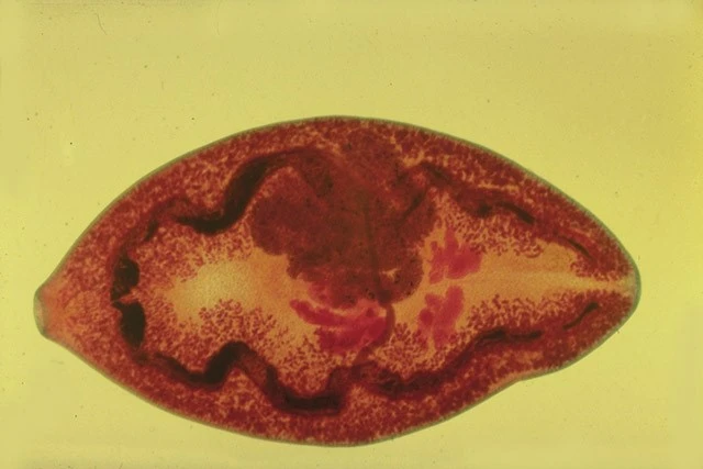 Bệnh sán lá phổi – Nguyên nhân, triệu chứng và cách chẩn đoán, điều trị hiệu quả tại Quy Nhơn