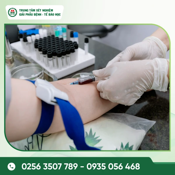 Lấy mẫu xét nghiệm ký sinh trùng - giun sán Lấy mẫu xét nghiệm ký sinh trùng - giun sán