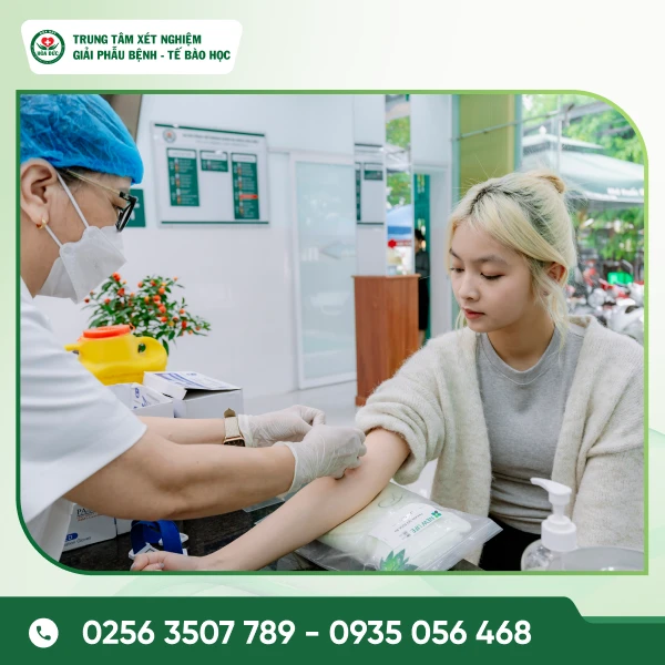 Xét nghiệm ký sinh trùng - giun sán tại Trung tâm Xét nghiệm Hoà Đức Xét nghiệm ký sinh trùng - giun sán tại Trung tâm Xét nghiệm Hoà Đức