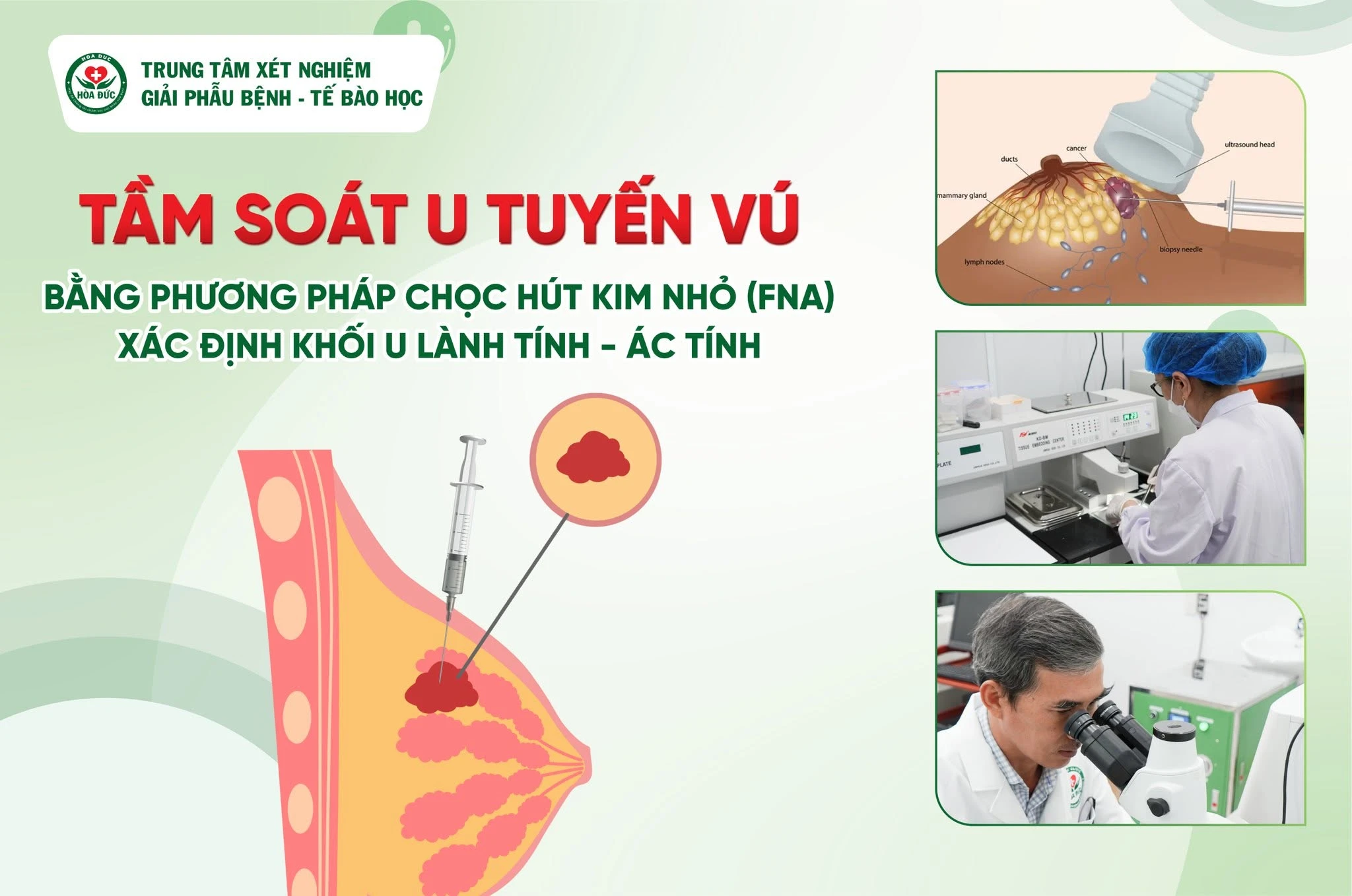 Tầm soát u tuyến vú (FNA) tại Phòng khám Hòa Đức