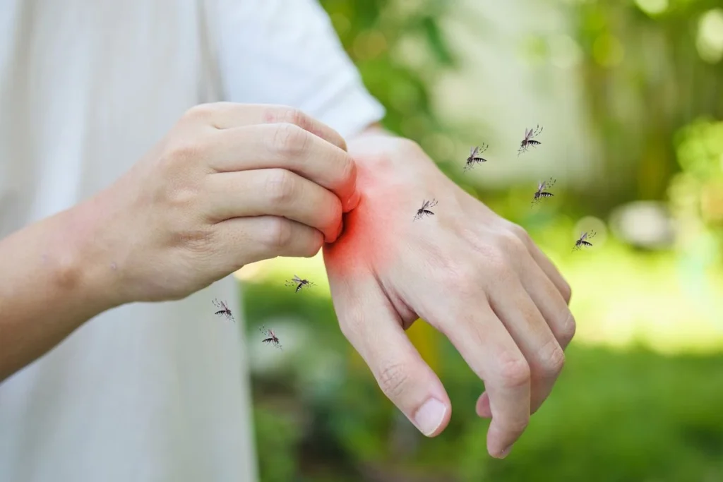Infected Insect Bite Treatment in Quy Nhon: A Quick Guide